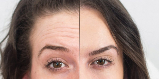 bridal beauty procedures