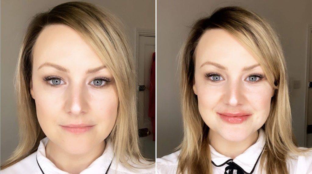bridal beauty procedures